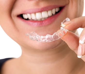 Woman trying on Invisalign clear aligners